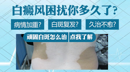 病因病理-夏季腹部白癜风发生扩散-常和这个因素有关-
